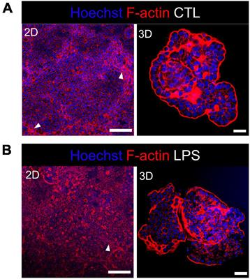 Disentangling the innate immune responses of intestinal epithelial cells and lamina propria cells to Salmonella Typhimurium infection in chickens